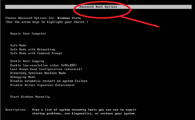 Advanced Boot Options-Bildschirmanleitung zum Zurücksetzen des Dell-Laptops auf die Werkseinstellungen ohne Kennwort